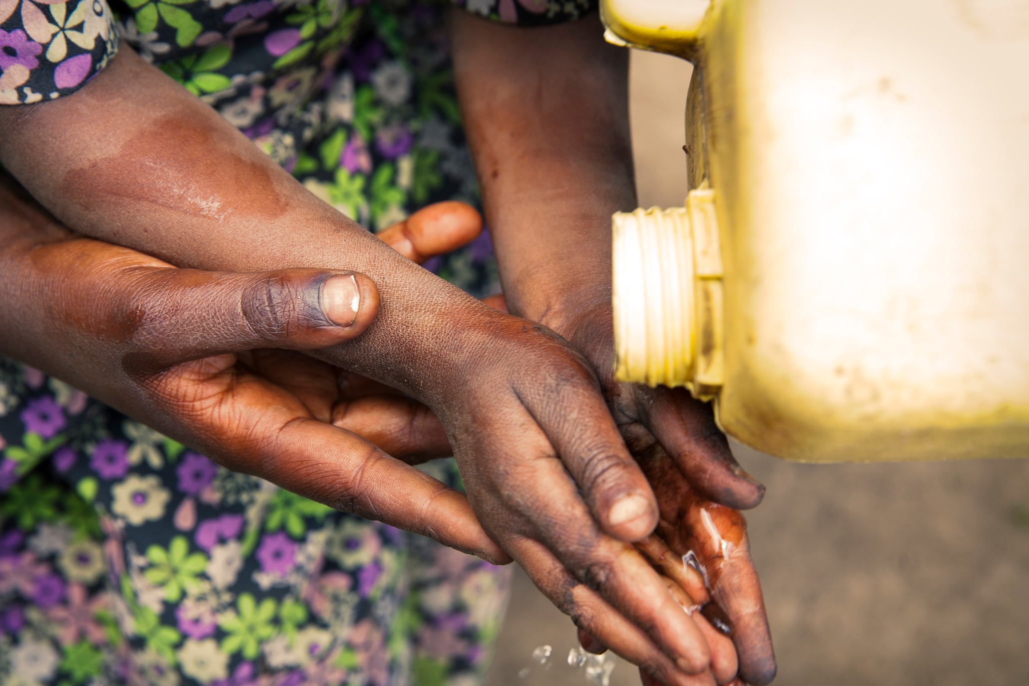 Water, Sanitation, and Hygiene (WASH)